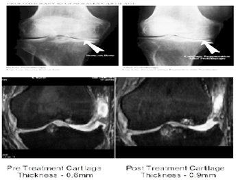 Electromagnetic Regeneration Therapy